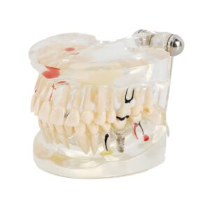 نموذج أسنان تشريحي لبي Dental Pulp Anatomy Model