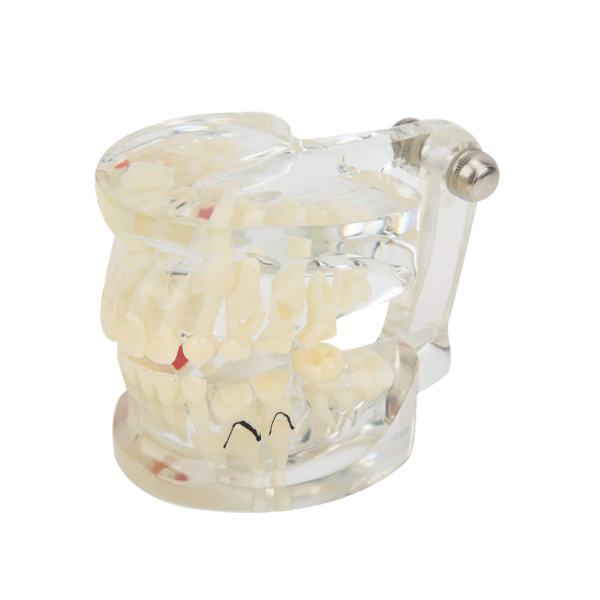 نموذج أسنان تشريحي للإطباق المختلط Dental Anatomy Model