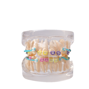 نموذج أسنان تشريحي تقويم Dental Ortho Anatomy Model