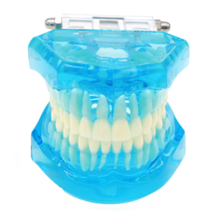 نموذج أسنان شفاف Dental Model